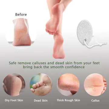 Natural Foot Pumice Stone for Feet, Borogo 2-Pack Lava Pedicure Tools Hard Skin Callus Remover for Feet and Hands - White&Red