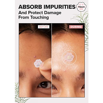 I DEW CARE Hydrocolloid Acne Pimple Patch - Cute & Effective