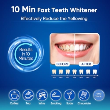 MySmile Teeth Whitening Kit for Sensitive Teeth, Fast Results