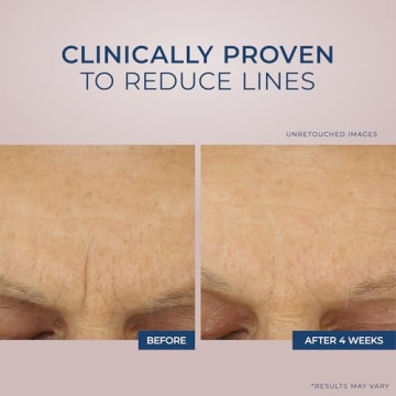 RoC Retinol Correxion Max Daily Hydrating Anti-Aging Cream