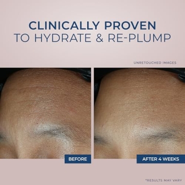 RoC Retinol Correxion Max Daily Hydrating Anti-Aging Cream