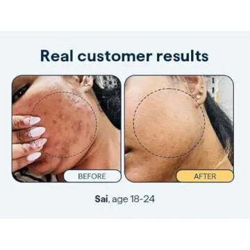 Effective Remedy for Dark Spots - Brighten Your Skin Naturally