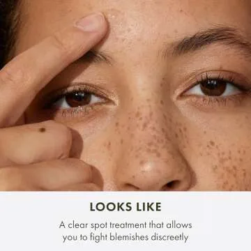Origins Spot Treatment with Salicylic Acid | Acne Solution