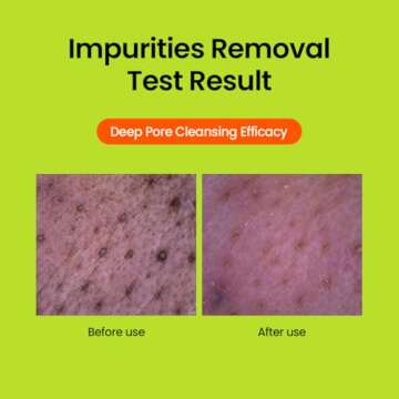 beplain Mung Bean pH-Balanced Cleansing Foam 2.7 fl. oz. (80ml) | Scent-free Cleanser | Gentle & Moisturizing Face Wash for All Skin Types | Makeup Remover | Korean Skin Care