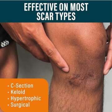 NUVADERMIS Scar Gel with Retinol, Allantoin, Vitamin E, Betaine - 1.7 Oz Silicone Gel Treatment for C-Section, Tummy Tuck, Keloid, Post-Surgery Scar Care - C Section Recovery Must Haves