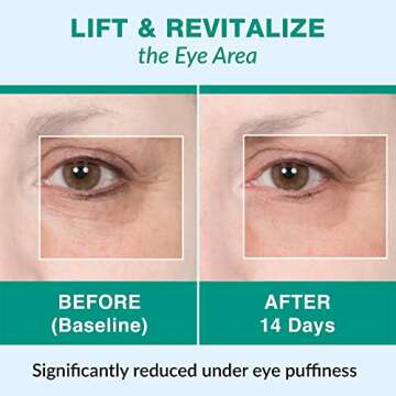 Lure Essentials 7 Cups with Exfoliating Brush Face and Body Cupping Therapy Set Facial Cupping Set with Body Cellulite Massage Cups