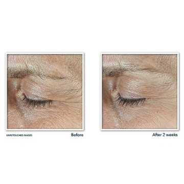 RoC Derm Correxion Dual Eye Cream for Dark Circles