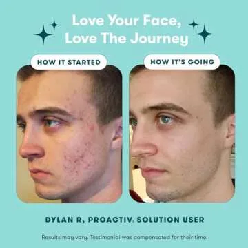 Proactiv 3 Step Acne Treatment - Benzoyl Peroxide Face Wash, Repairing Acne Spot Treatment for Face and Body, Exfoliating Toner - 30 Day Complete Acne Skin Care Kit