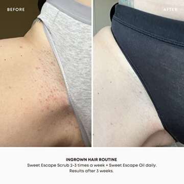 Bushbalm Ingrown Hair and Razor Bumps 2-Step Routine - Moisturize and Calm - Ingrown Hair Oil (30 ml) and Exfoliating Scrub (236 ml) - Sweet Escape