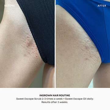 Bushbalm Ingrown Hair and Razor Bumps 2-Step Routine - Moisturize and Calm - Ingrown Hair Oil (30 ml) and Exfoliating Scrub (236 ml) - Sweet Escape