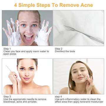 Pimple Popper Tool Kit, UUBAAR 9 PCS Blackhead Remover Tools with Tweezers, 16-Heads Professional Acne Zit Pimple Popper Extraction Tools, Whitehead Comedone Extractor Kit for Facial Nose