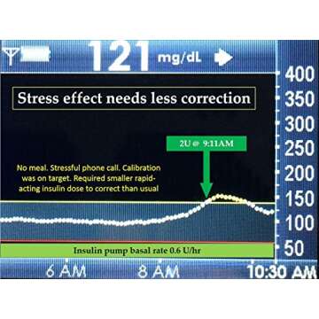 Sugar Surfing: How to Manage Type 1 Diabetes in a Modern World