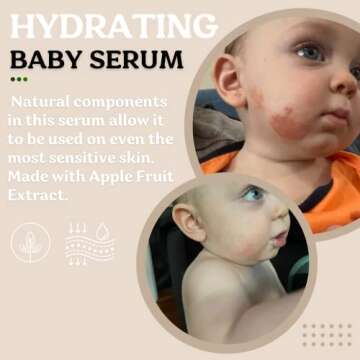 Roe Wellness- Baby Serum Hydrating Skincare Probiotic Protection | Hydrate, Soothe, Clean Ingredient...