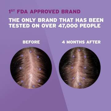 Rogaine Women's 2% Minoxidil Topical Solution for Womens Hair Thinning and Loss & Hair Regrowth, 3-M...