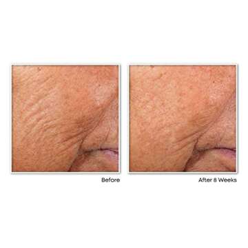 RoC Retinol Night Serum Capsules - Anti-Aging Gift Set