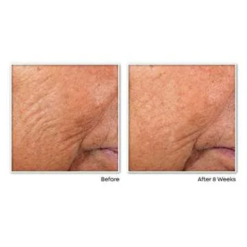 RoC Retinol Night Serum Capsules - Anti-Aging Gift Set