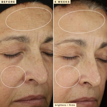 Farmacy Vitamin C Face Serum for Bright & Firm Skin