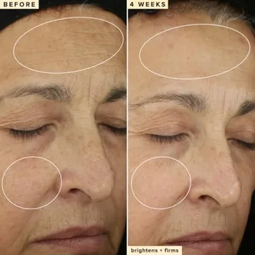 Farmacy Vitamin C Face Serum for Bright & Firm Skin