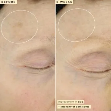 Farmacy Vitamin C Face Serum for Bright & Firm Skin