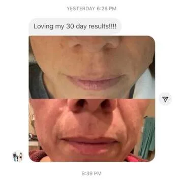 Frownies Forehead & Eye Patches - Natural Anti-Aging Solution