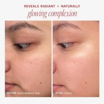 First Aid Beauty Facial Radiance Pads for Bright Skin