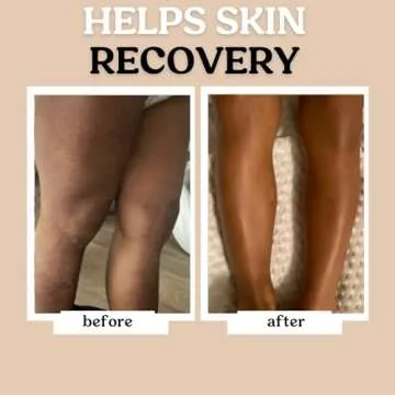 Roe Wellness Baby Lotion for Sensitive Skin, Fragrance-Free