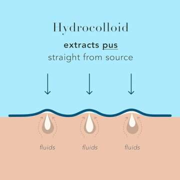 Rael Pimple Patches, Miracle XL Spot Control Cover - Hydrocolloid Acne Patch for Face, Zits & Blemish, Back and Body, Korean Skin Care, Vegan, Cruelty Free (6 Count)