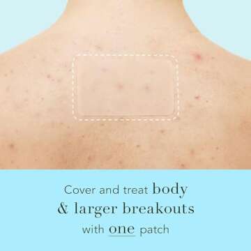 Rael Pimple Patches, Miracle XL Spot Control Cover - Hydrocolloid Acne Patch for Face, Zits & Blemish, Back and Body, Korean Skin Care, Vegan, Cruelty Free (6 Count)