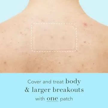 Rael Pimple Patches, Miracle XL Spot Control Cover - Hydrocolloid Acne Patch for Face, Zits & Blemish, Back and Body, Korean Skin Care, Vegan, Cruelty Free (6 Count)