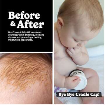 Coconut Baby Oil for Hair & Skin Care, Natural & Organic, Coconut Oil for Cradle Cap, and Infant Scalp Relief, Hair Oil for Adult and Newborn, Sensitive Skin Moisturizer, Unscented - 2 fl oz