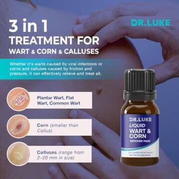 Plantar Wart Corn Remover Freeze Off 17% Salicylic Acid