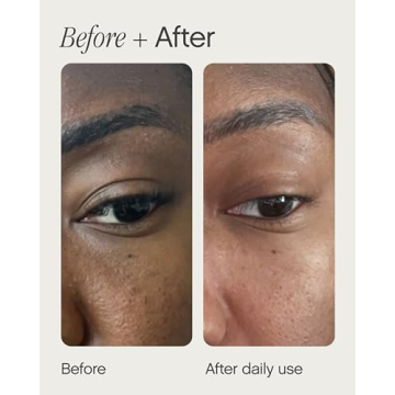 Topicals Sealed Primer for Acne Scars & Pores - 1 Oz