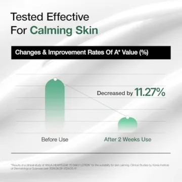 Lightweight Face Moisturizer by Anua for Sensitive Skin