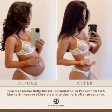 Fearless MaMa Belly Butter for Stretch Mark Prevention