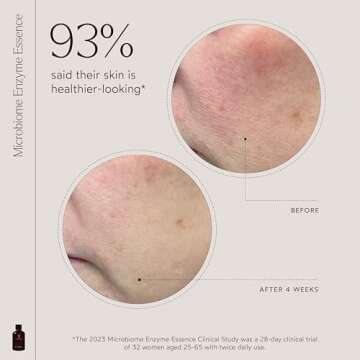 True Botanicals Microbiome Enzyme Essence | Hydrating & Resurfacing Benefits for All Skin Types | Gives a Dewy Looking Complexion | Dermatologist Tested, All Natural, Vegan | 4 fl oz | 118 ml