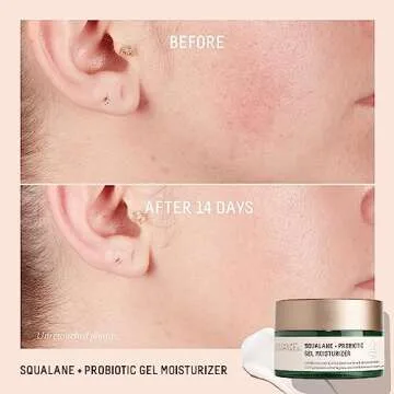 Biossance Squalane + Probiotic Balancing Face Gel Moisturizer - Advanced Formula for Oily & Acne-Prone Skin, Encapsulated Probiotics, Reduces Redness & Excess Oil, Soothes Sensitive Skin - 1.69 oz