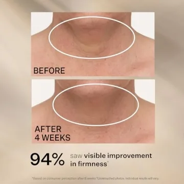 StriVectin Neck Cream for Tightening and Lifting Skin