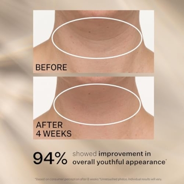 StriVectin Neck Cream for Tightening and Lifting Skin