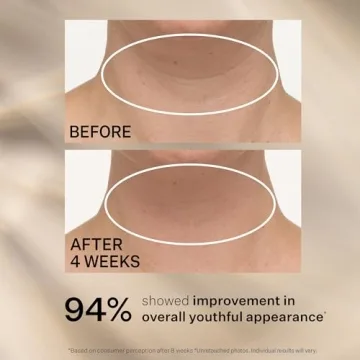 StriVectin Neck Cream for Tightening and Lifting Skin