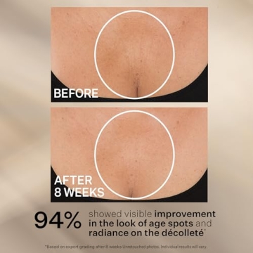 StriVectin Neck Cream for Tightening and Lifting Skin