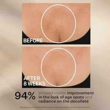 StriVectin Neck Cream for Tightening and Lifting Skin