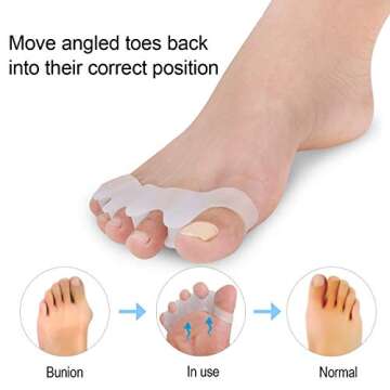 2 Pair Gel Bunion Corrector Kids Toe Separator, for Overlapping Toe,Bunion Corrector Pads for Bunion Relief Splint,Toe Separators, Big Toe Space Suitable for Bunion Pain Relief and Overlapping Toes