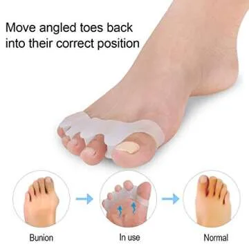 2 Pair Gel Bunion Corrector Kids Toe Separator, for Overlapping Toe,Bunion Corrector Pads for Bunion Relief Splint,Toe Separators, Big Toe Space Suitable for Bunion Pain Relief and Overlapping Toes