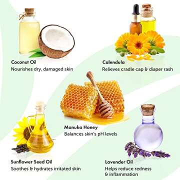 Organic Calendula Ointment Baby Rash Cream - Baby Eczema Cream, Cradle Cap Treatment, Diaper Rash Ointment, Baby Butt Cream - Calendula Oil, Manuka Honey, Lavender, and Coconut - Baby Skin Care (2oz)