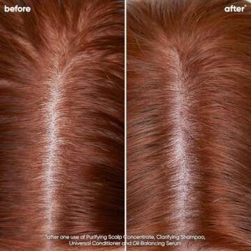 Biolage Scalp Sync Clarifying Shampoo - Residue & Buildup Remover, For Oily Scalp, With Fermented Tea & Glycolic Acid, Vegan & Paraben-Free, 13.5 Fl Oz, Packaging May Vary