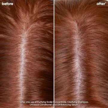 Biolage Scalp Sync Clarifying Shampoo - Residue & Buildup Remover, For Oily Scalp, With Fermented Tea & Glycolic Acid, Vegan & Paraben-Free, 13.5 Fl Oz, Packaging May Vary