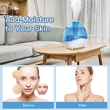 Loerio Cool Mist Humidifier with Night Light for Home