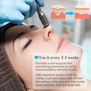 Professional Diamond Microdermabrasion Machine