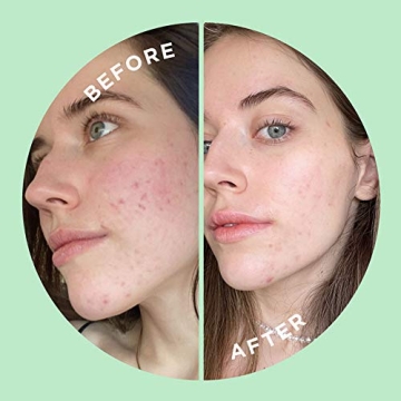 ZitSticka Press Refresh Sheet Masks - Exfoliating & Hydrating