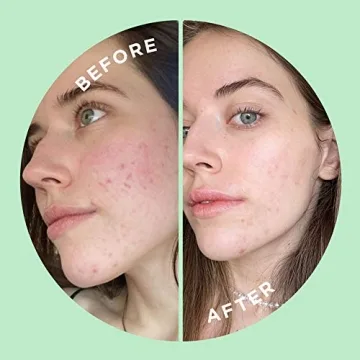 ZitSticka Press Refresh Sheet Masks - Exfoliating & Hydrating